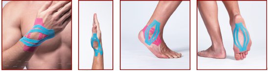 kinesiotaping