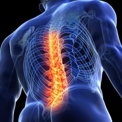 Urazy kręgosłupa - rodzaje, objawy, leczenie
